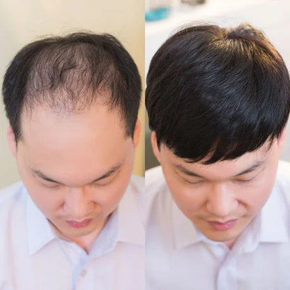 Men's wig-FOREVER GOODBYE TO BALD HEAD ANXIETY